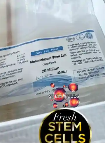 hUC Fresh MSC Stem Cells